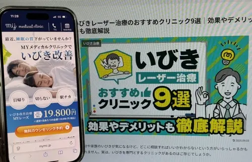 MYメディカルクリニックのいびきレーザー治療