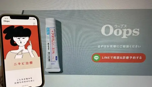 Oops（ウープス）のニキビ治療